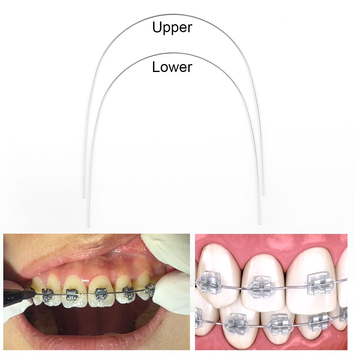 MacDent Dental Orthodontic Braces Bracket Mini Roth.022 Hook345 Arch Wire Nature