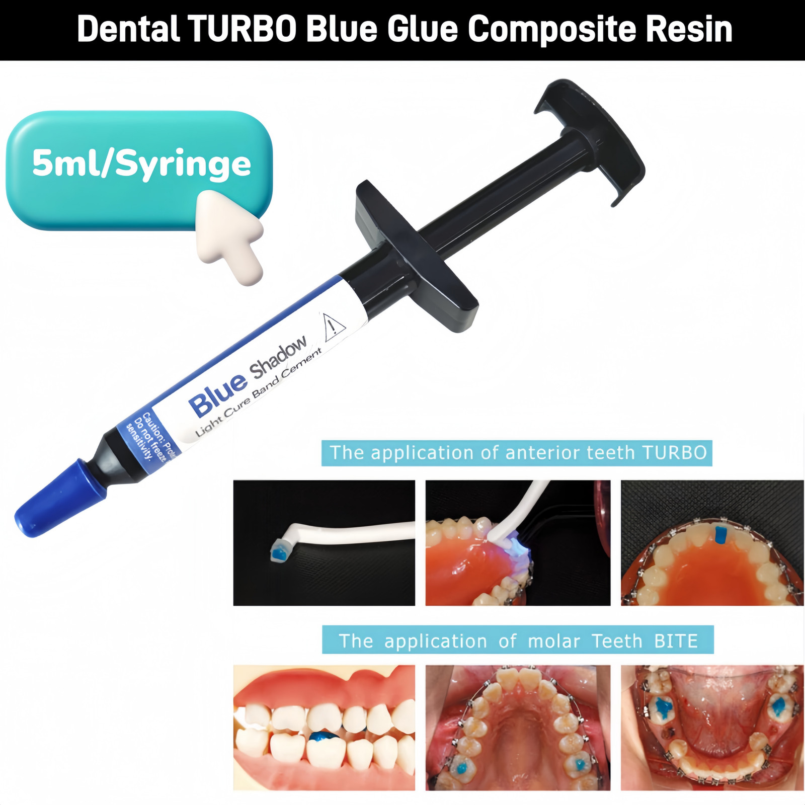 Dental TURBO Blue Glue Composite Resin 5ml Orthodontic Adhesive Light Cure Band