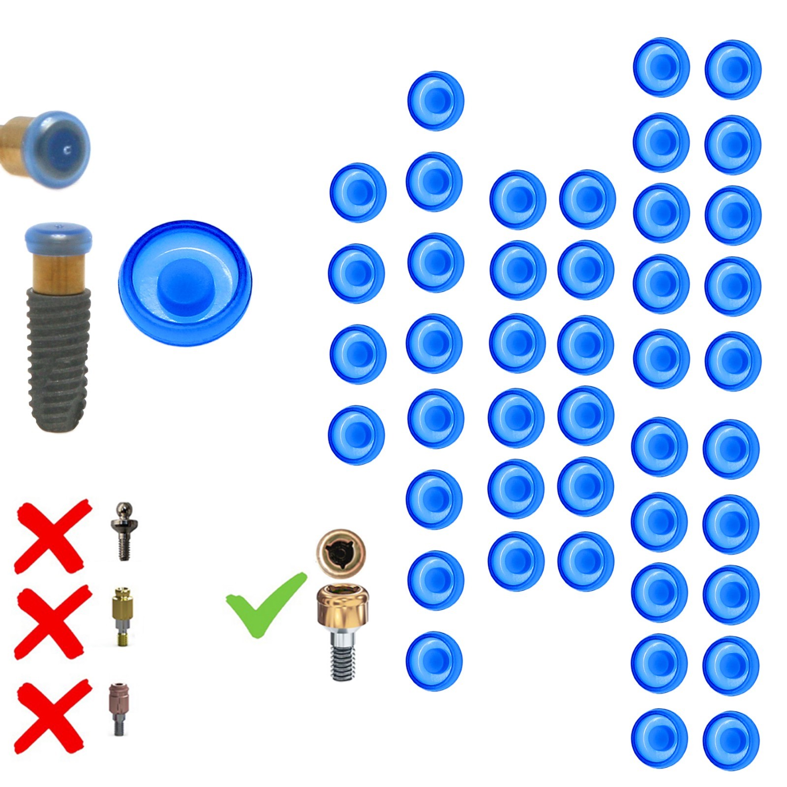 US Locator Extended Standard Range Inserts Retention cap For zest overdenture