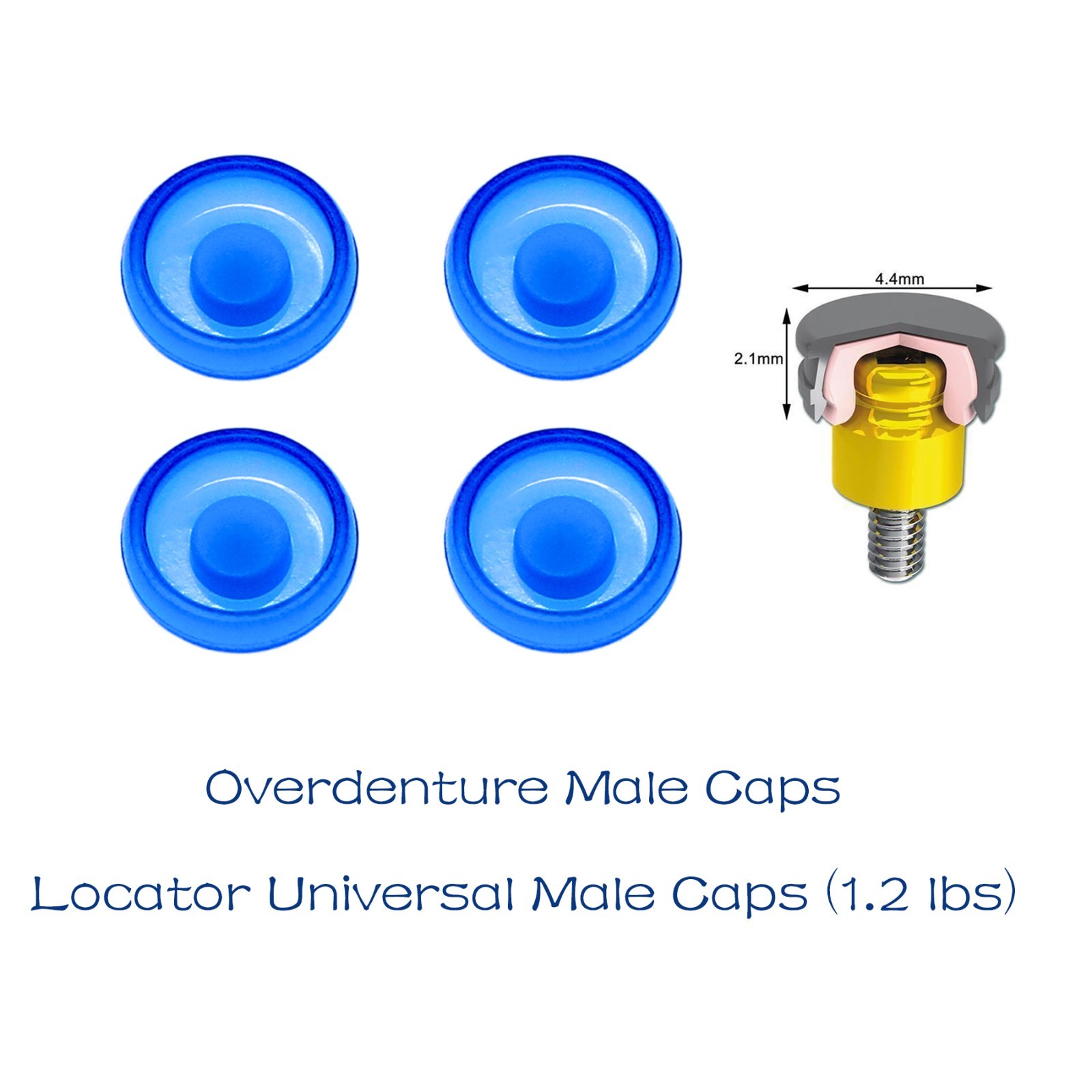 4Pcs Dental Fit Zest Locator Male Cap Inserts Overdenture Attachment Replacement